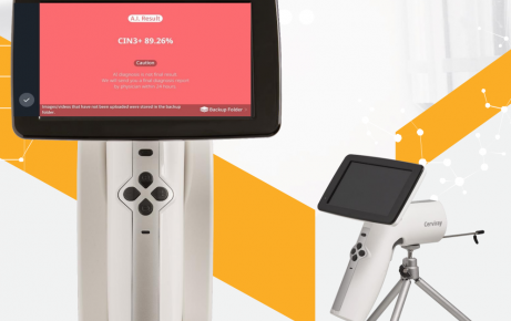 Máy soi cổ tử cung Cerviray AI