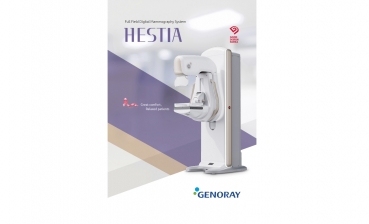 Mammography system